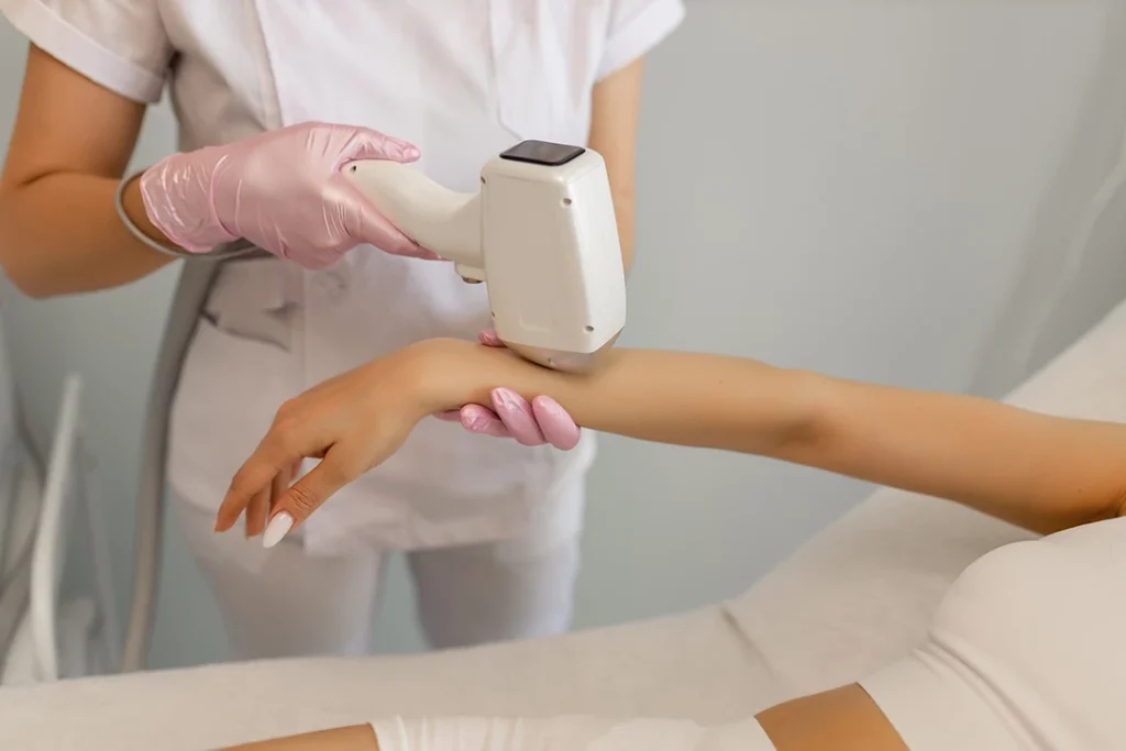 Laser hair removal training on arm at a professional laser hair removal school in King William