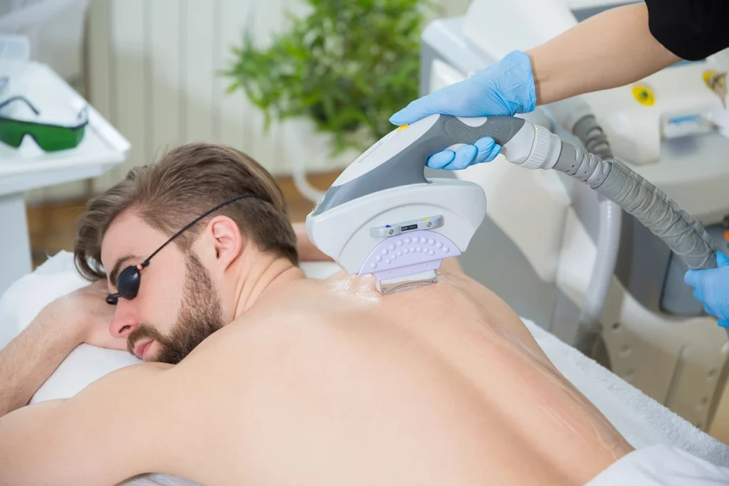 Laser Hair Removal Course in Tobin Hill procedure with technician using laser device on patient’s back