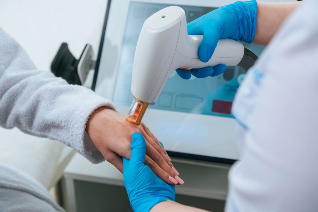 Professional using laser on hand, ideal for laser hair removal course San Antonio training.