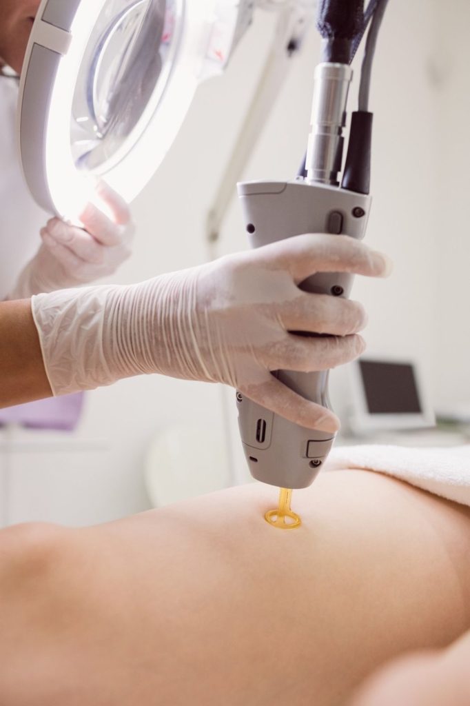 A technician using a laser device on a client’s skin, ideal for laser hair removal technician training San Antonio.