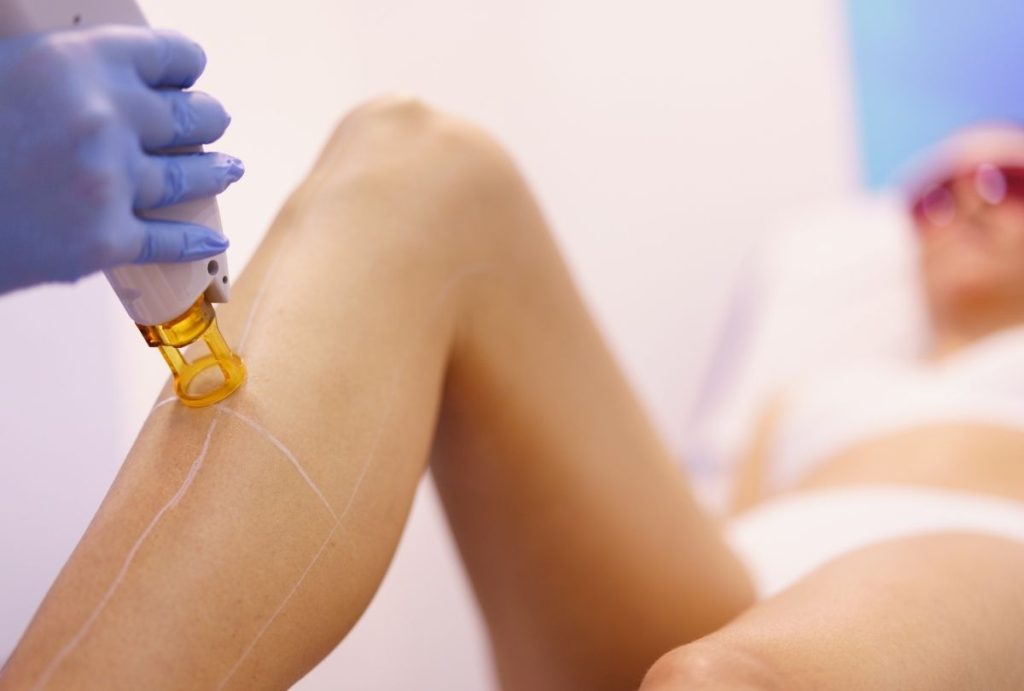 Gloved hand using yellow-tipped laser device on marked leg area of client during precise medical aesthetics laser training procedure in a professional setting. 