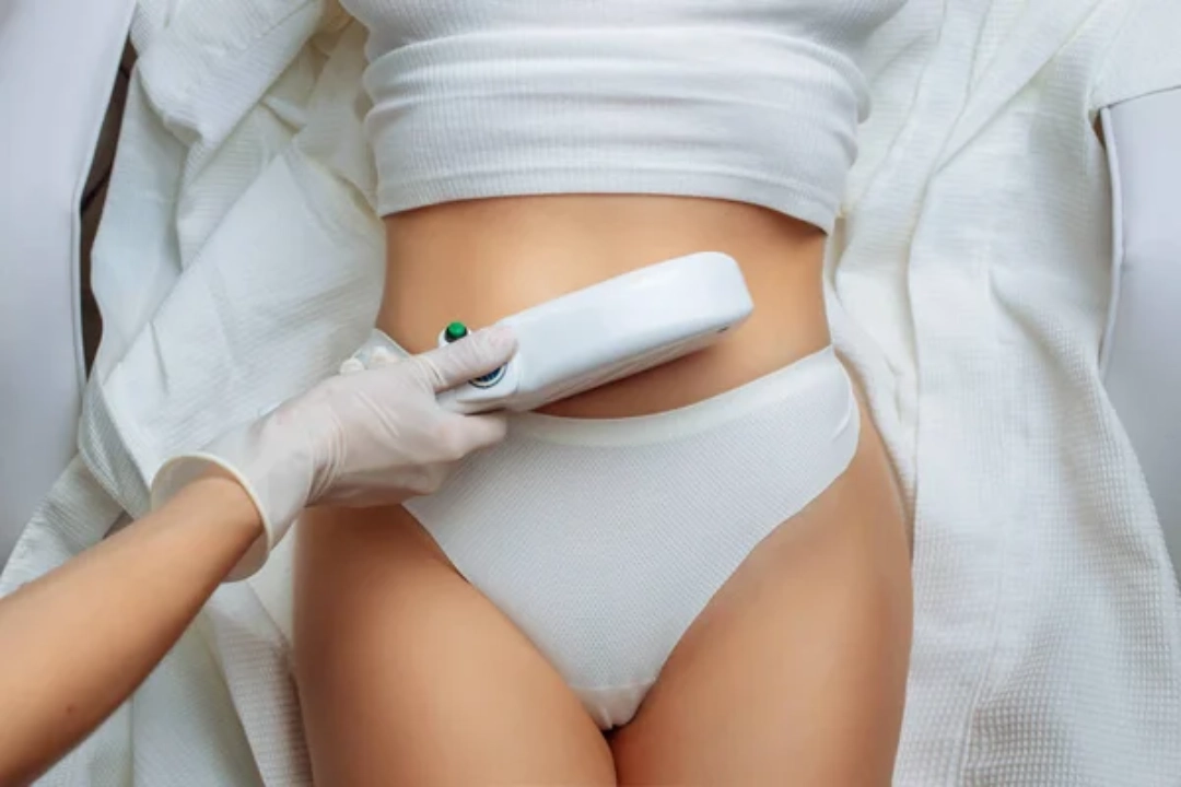 Advanced laser hair removal technician training Woodlands courses demonstrate safe stomach hair removal with modern tools.