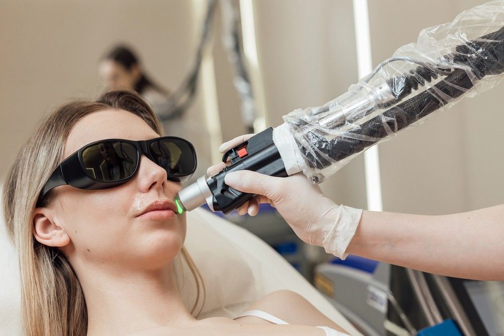 A close-up of a patient receiving facial laser treatment on the upper lip, showcasing laser hair removal education.